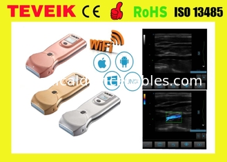 Warna mesin doppler medis nirkabel harga mesin USG scanner nirkabel portabel untuk komputer dan telepon
