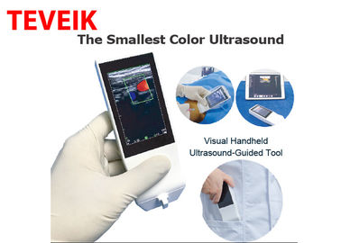 Mesin Ultrasound Wifi Medis Android Probe Ultrasound Nirkabel Portabel Linear