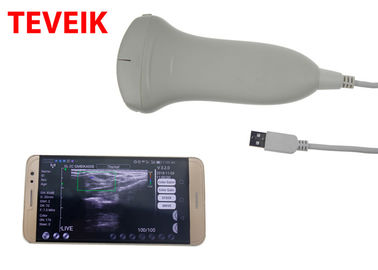 CE USB Mesin Ultrasound Laptop Tablet Ultrasound Scanner Convex Probe