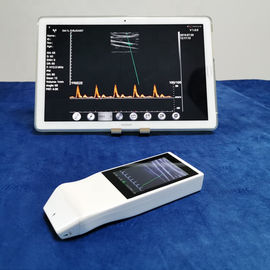 Wireless Ultrasound Tranducer Android Colour Doppler Ultrasound Probe Pengisian Nirkabel