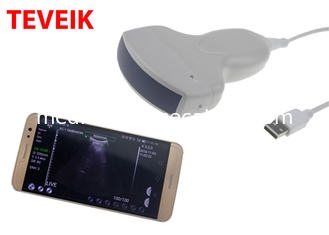 Warna Mesin Ultrasound Wifi Nirkabel Protable probe ultrasound nirkabel Cembung